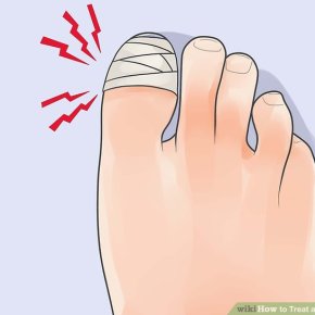 Objektiivinen todellisuus ja kolhaistut&nbsp;varpaat